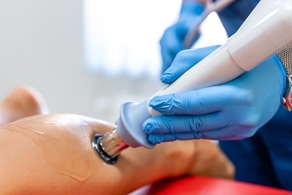 varizes e trombose, exame de ultrassom Doppler