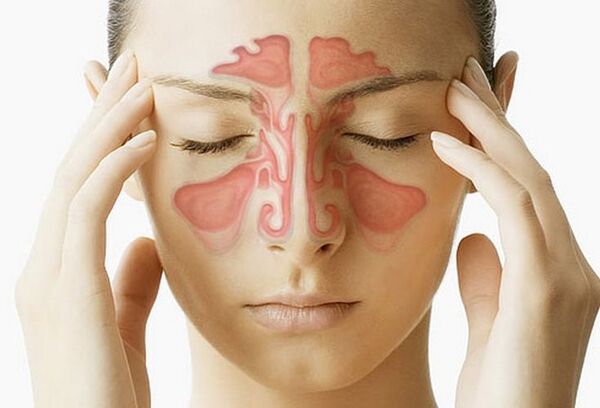 tomografia para o diagnostico da sinusite