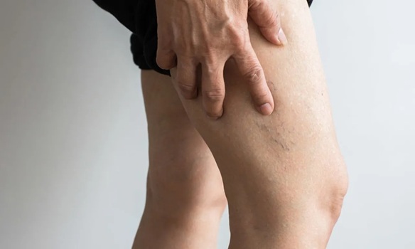 ultrassom com Doppler