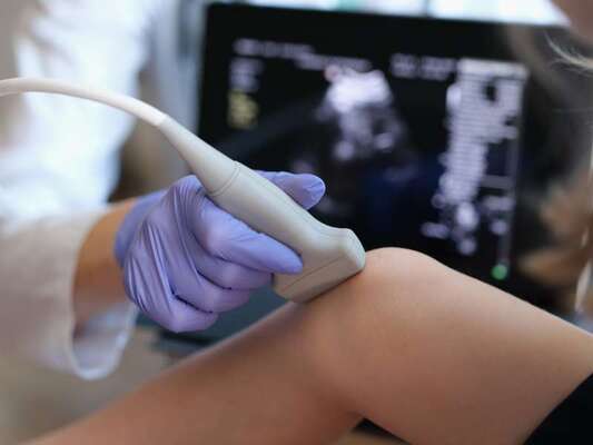 ultrassom com Doppler nas pernas